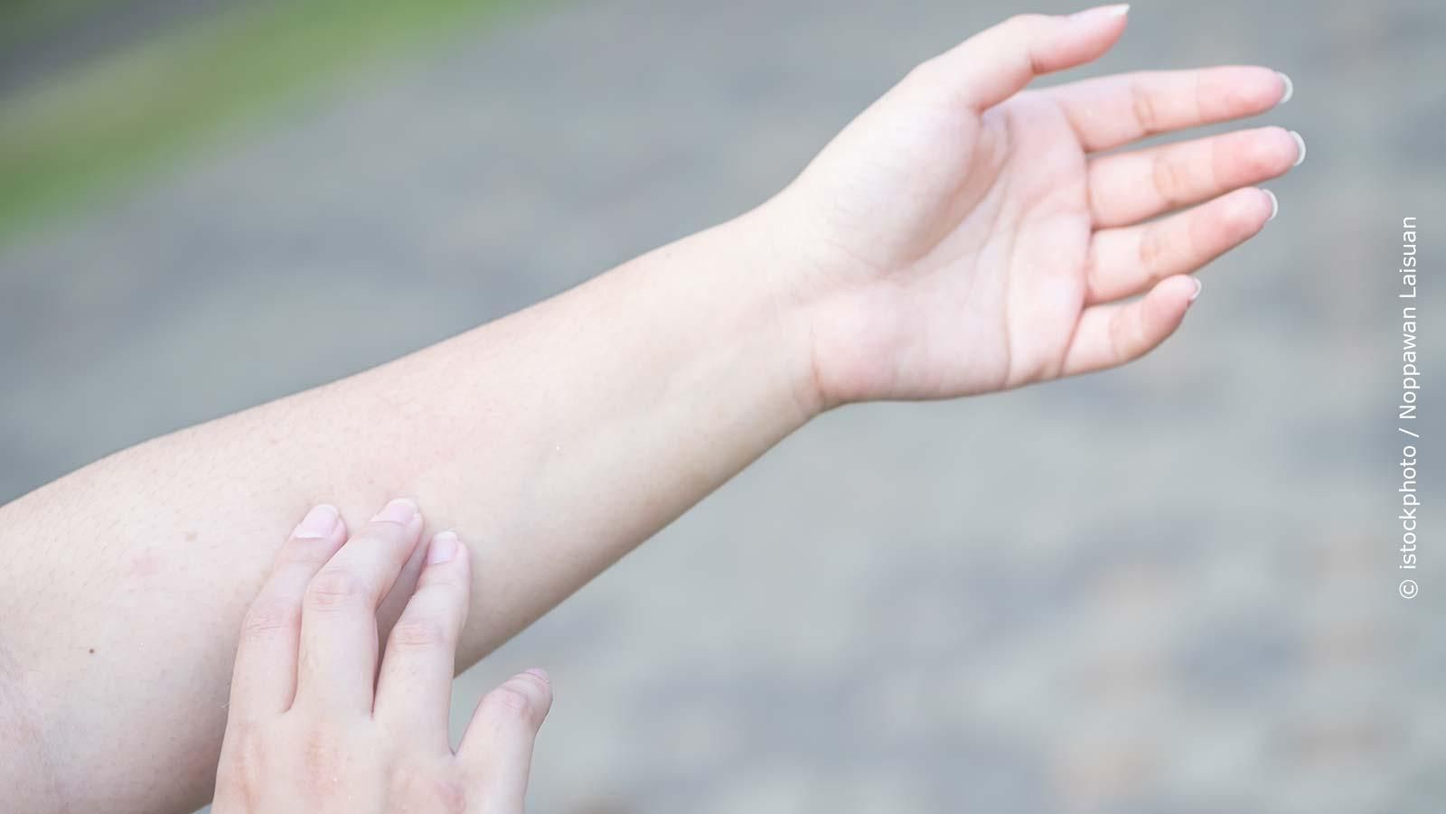 Unterarm wird gekratzt